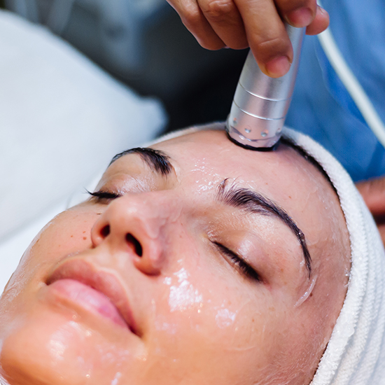 Peeling Químico